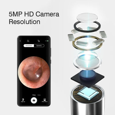 3.9mm HD Digital WiFi Ear Otoscope met AI Directional Function en WiFi Connectivity