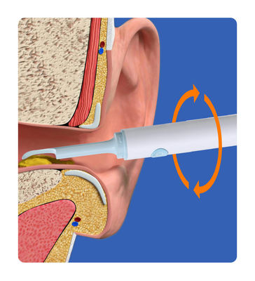 Smart Visual Ear Cleaning Rod Medische camera Endoscoop voor andere huishoudelijke chemicaliën